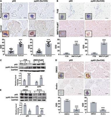 Andrographolide Suppresses the Growth and Metastasis of Luminal-Like Breast Cancer by Inhibiting the NF-κB/miR-21-5p/PDCD4 Signaling Pathway